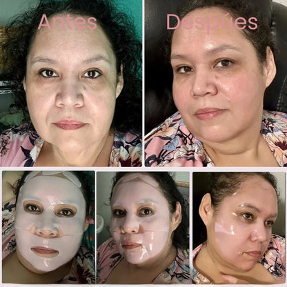Piel cansada, solución inmediata: La mejor mascarilla de colágeno para tu piel 💖