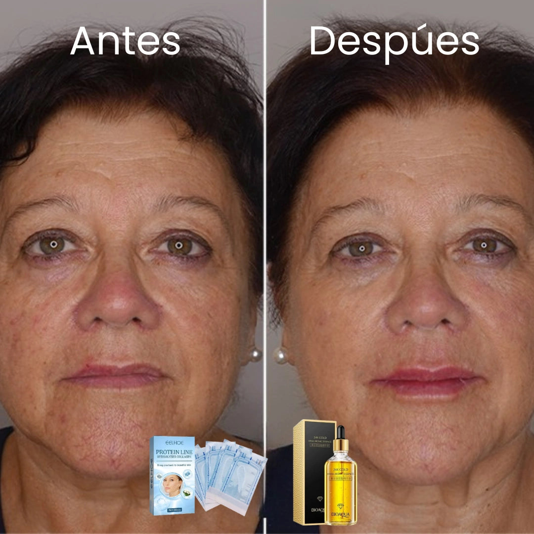 Hilos de Colágeno + Sérum 24k de Acido Hialuronico
