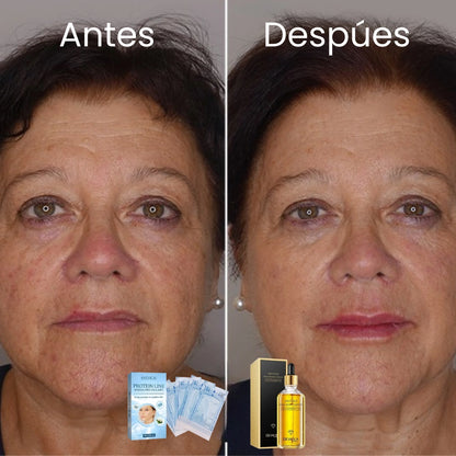 Hilos de Colágeno + Sérum 24k de Acido Hialuronico