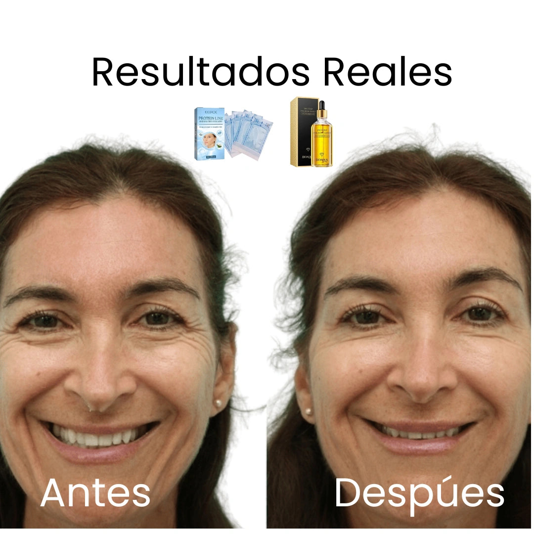 Hilos de Colágeno + Sérum 24k de Acido Hialuronico